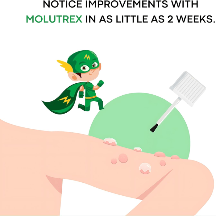 ACM Molutrex 5% Topical Solution 3ML
