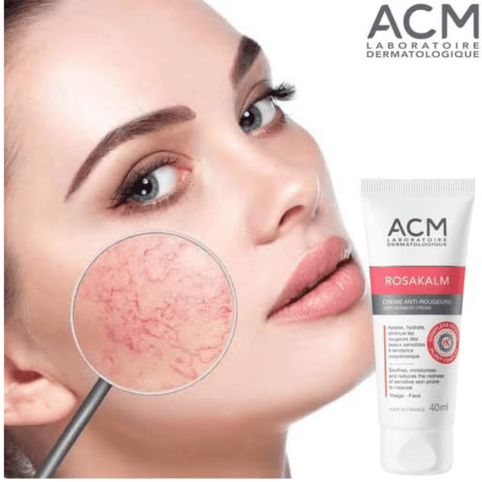 ACM Rosakalm Anti-Redness Face Cream 40 ml