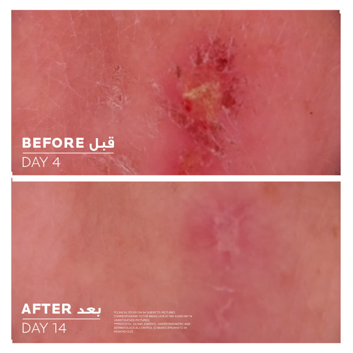 La Roche Posay Cicaplast Baume B5+ Ultra-Repairing Balm 40ml