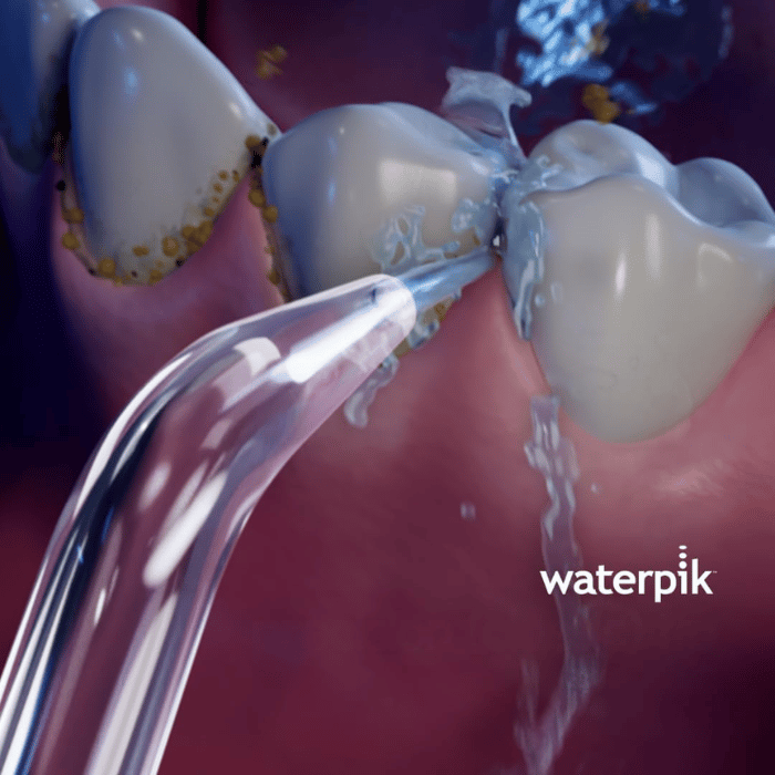 Waterpik Replacement Jet Tips