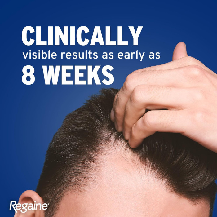 Regaine For Men 5% Hair Regrowth Foam 73ml - 3 Pack