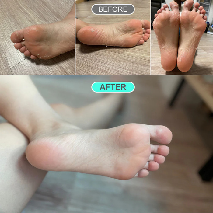 Kocostar Premium Foot Peeling Pack Medium 50ml 1s