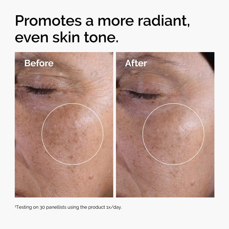 The Ordinary Glycolic Acid 7% Toning Solution, Exfoliating Toner for Glowing, Smooth & Even-Toned Skin 240ml